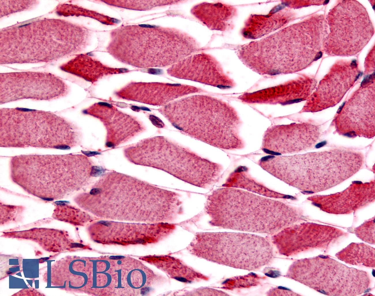 IHC-plus™ PYGM Antibody (Internal)