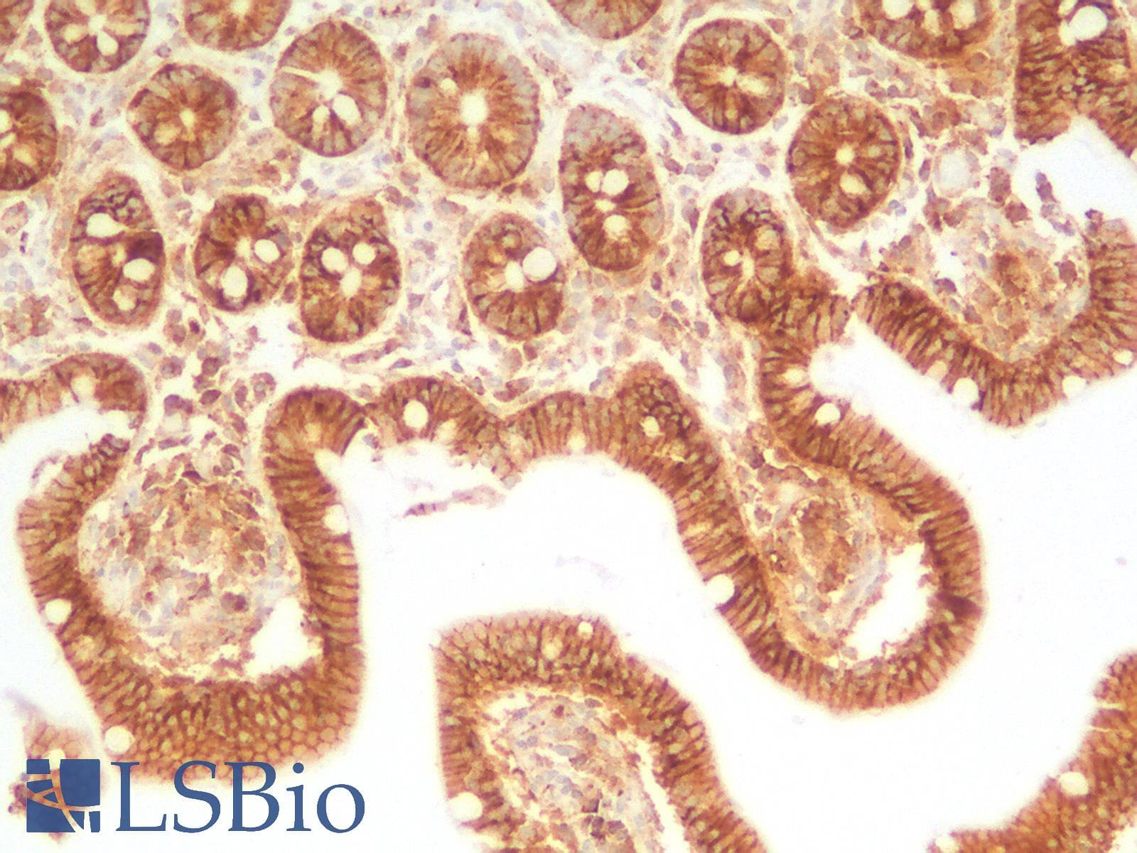 PathPlus™ SDC1 / Syndecan 1 / CD138 Antibody (Concentrated)