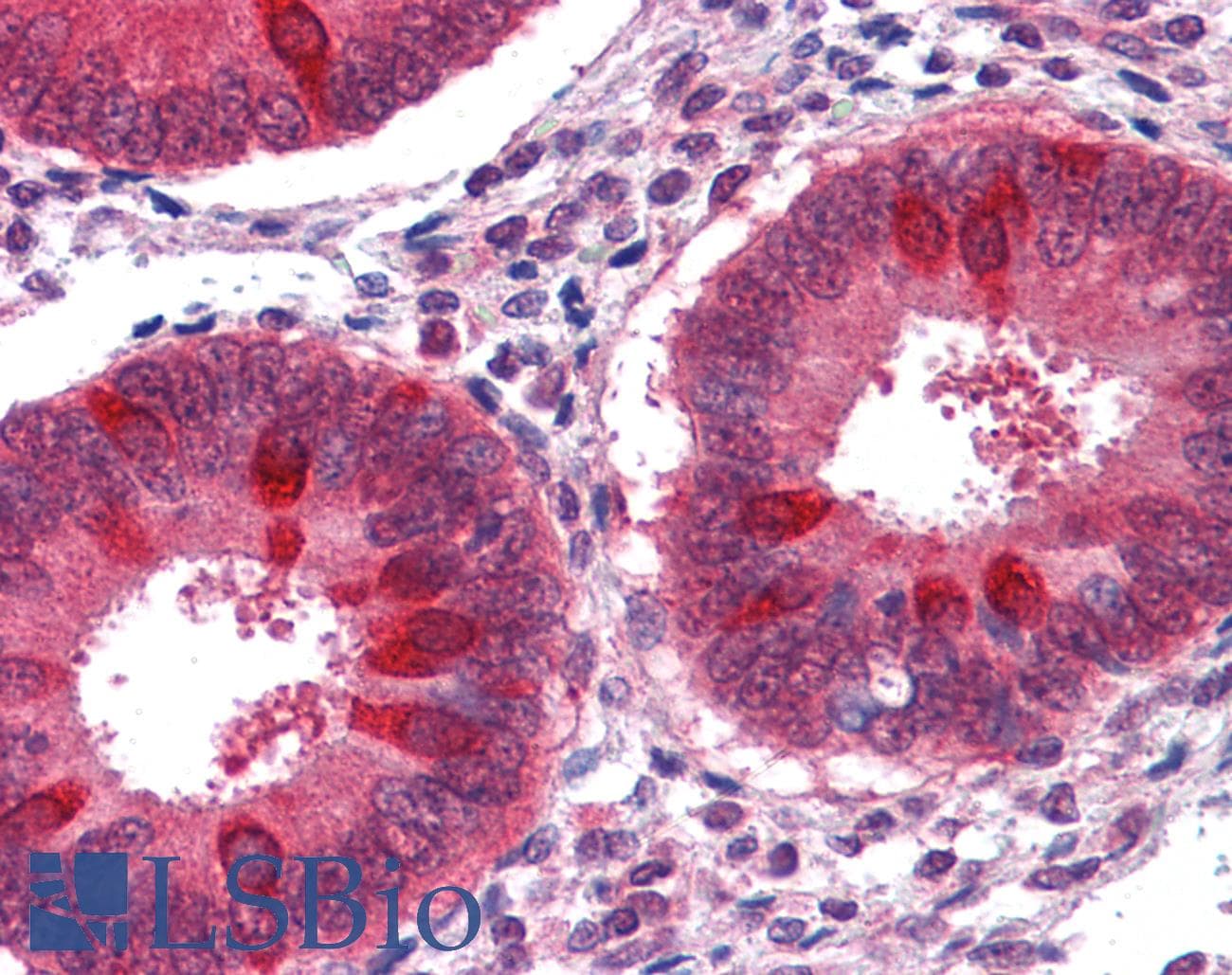 IHC-plus™ TIP48 / RUVBL2 Antibody
