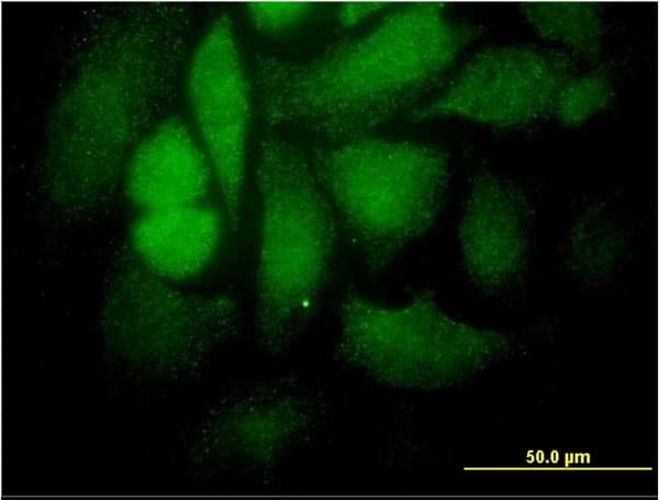 IHC-plus™ Monoclonal Mouse anti-Human STAT4 Antibody (clone 1C2-1C12, IHC, IF, WB)