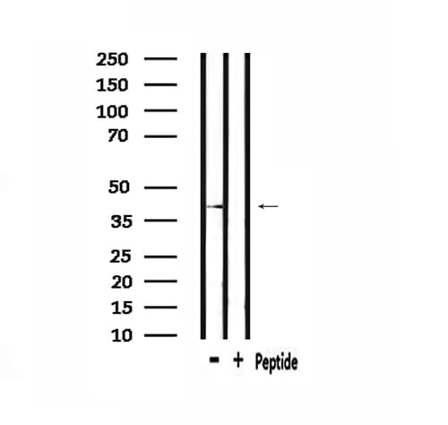 HORMAD1 Antibody