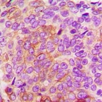 Polyclonal Rabbit anti-Human STXBP4 Antibody (IHC, WB)