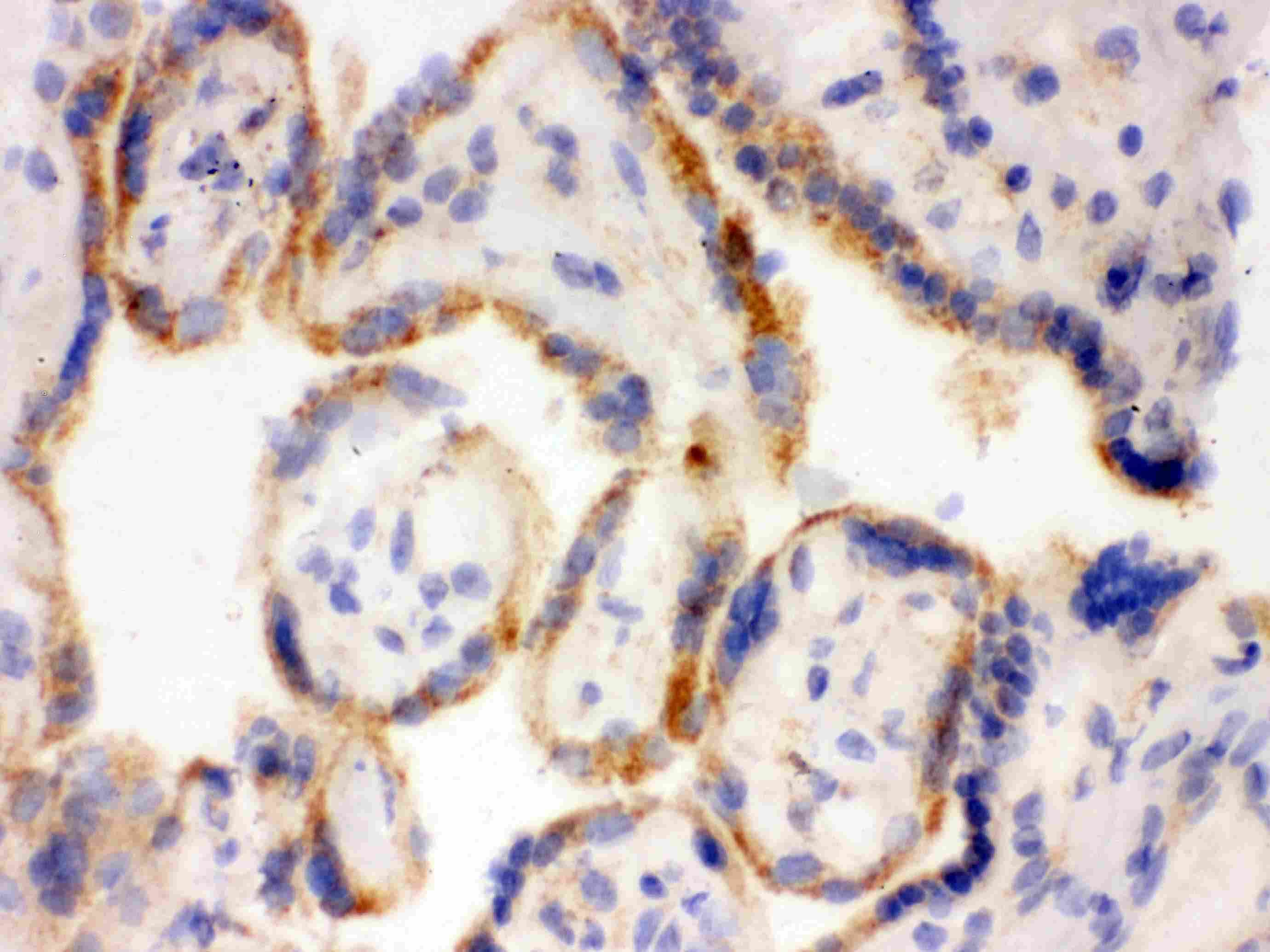 SFTPD / Surfactant Protein D Antibody (aa292-321)