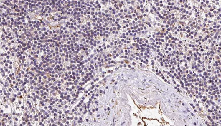 IFT52 Antibody