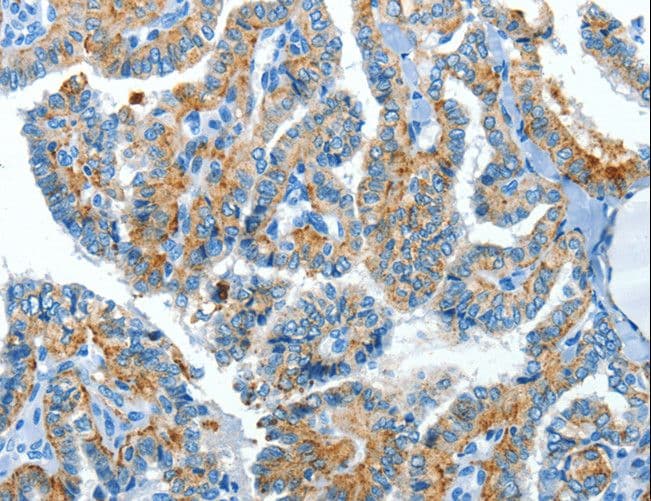 Polyclonal Rabbit anti-Human CLPTM1L / CLPTM1-Like Antibody (IHC)