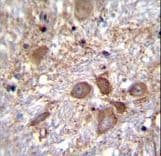 SPECC1 / CYTSB Antibody (aa705-733)