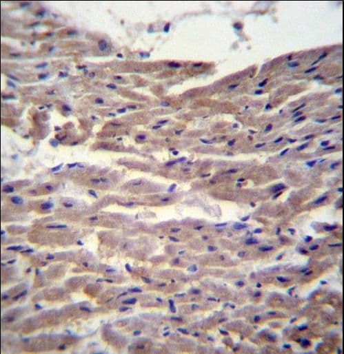 MYBPC3 / MYBP-C Antibody (aa189-218)