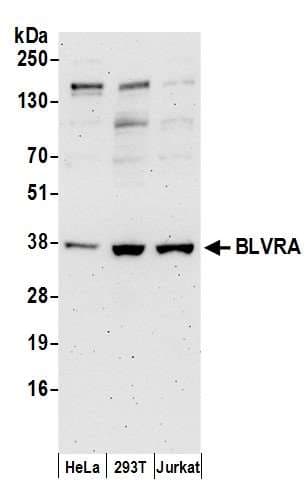 BLVRA Antibody (aa75-125)