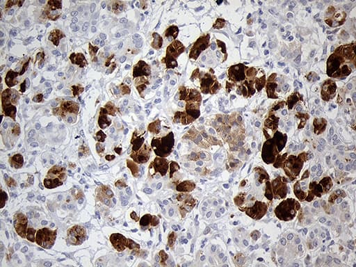 Monoclonal Mouse anti-Human PNLIP / PL / Pancreatic Lipase Antibody (clone OTI9A9, aa355-465, IHC, WB)