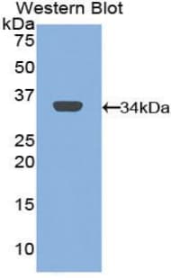 Mannose Receptor / CD206 Antibody (aa225-492)