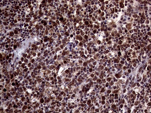 Monoclonal Mouse anti-Human STX18 / Syntaxin 18 Antibody (clone OTI3D7, aa1-285, IHC, WB)