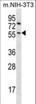 GSK3B / GSK3 Beta Antibody (aa30-59)