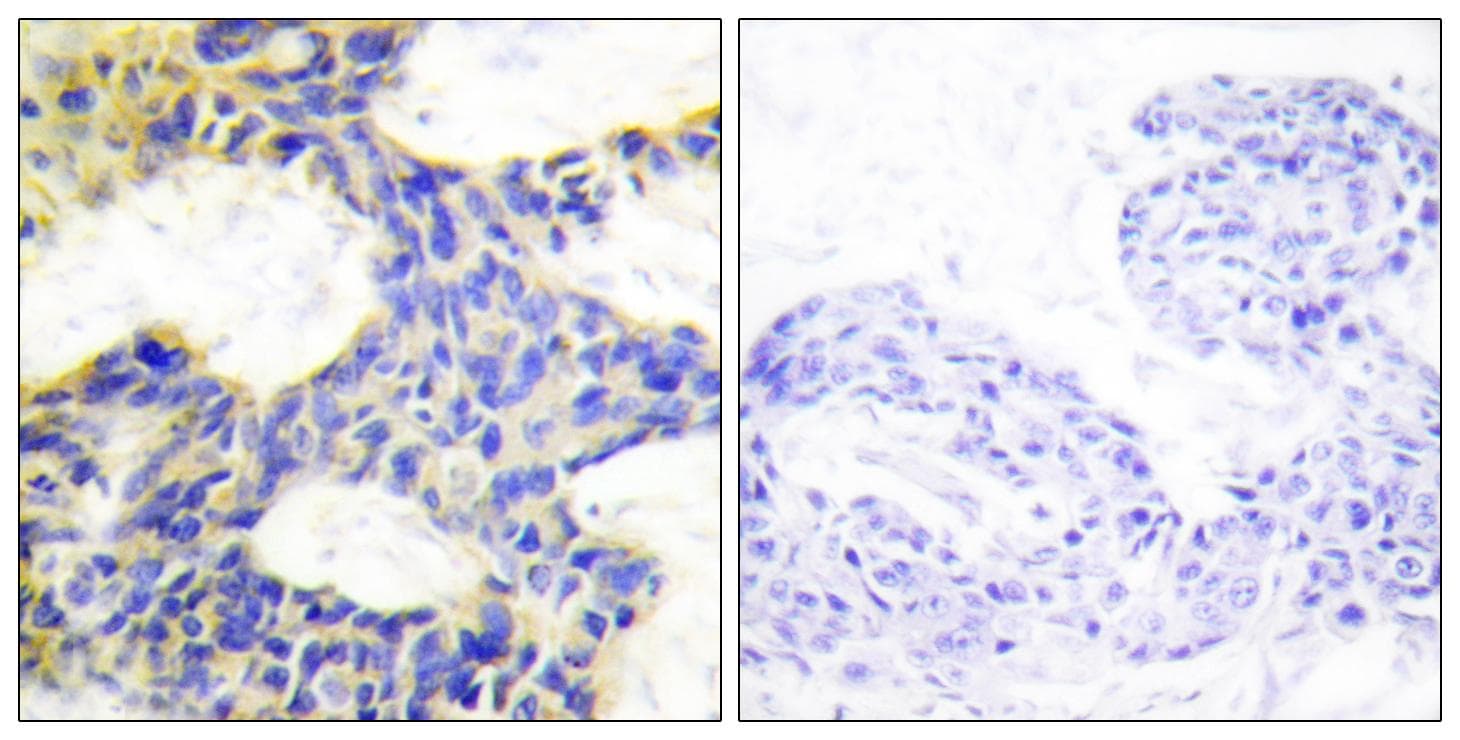 LYS6K2 Antibody