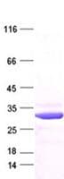 Human CDKN1B / p27 Kip1 Protein (Recombinant DDK,C-terminus)