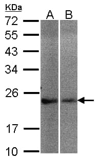 Polyclonal Rabbit anti-Human NCS1 / Neuronal Calcium Sensor Antibody (aa1-138, WB)