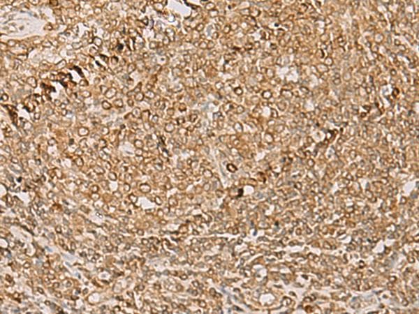 PSMD12 / Rpn5 Antibody