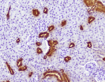 CALB1 / Calbindin Antibody