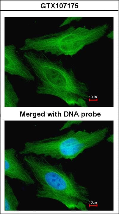 PathPlus™ TUBB / Beta Tubulin Antibody (aa174-428)