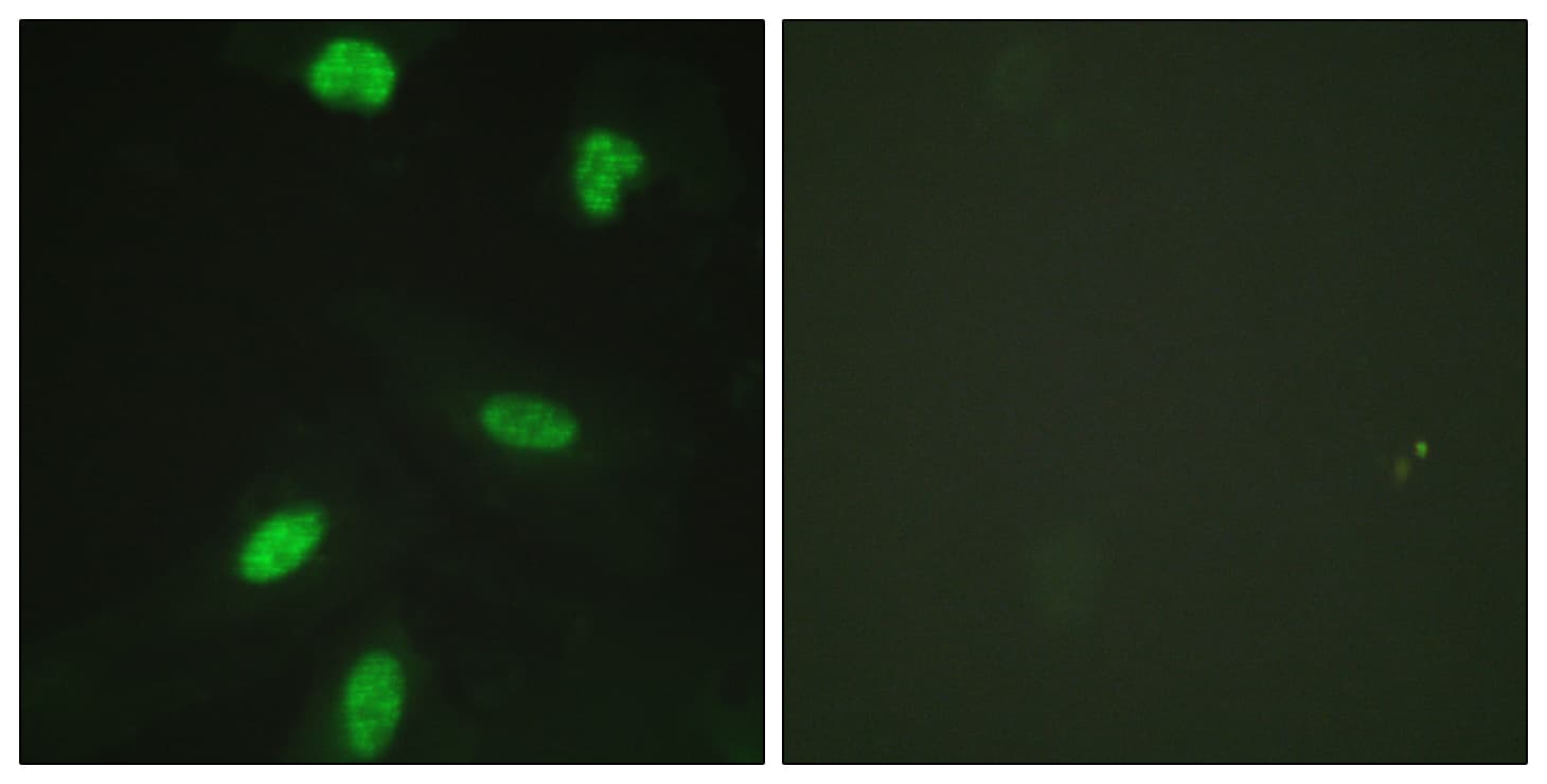 Polyclonal Rabbit anti-Human RB1 / Retinoblastoma / RB Antibody (phospho-Thr821, IHC, IF)