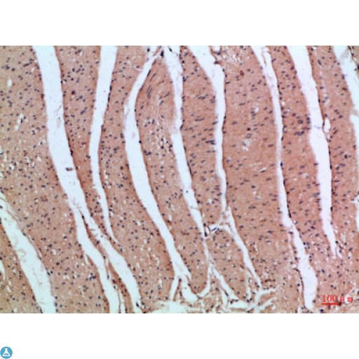 PIK3R2 / p85 Beta Antibody