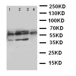 Polyclonal Rabbit anti-Human PTHR / PTHR1 Antibody (aa388-406, IHC, WB)