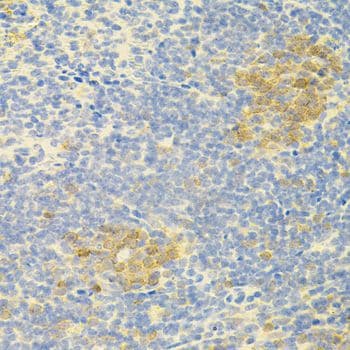 APP / Beta Amyloid Precursor Antibody