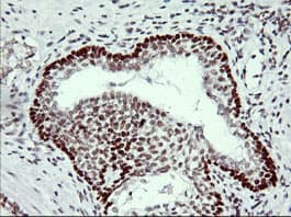 TP73 / p73 Antibody (clone OTI2H5)