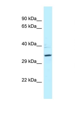 Polyclonal Rabbit anti-Human PPP2R4 Antibody (aa39-88, WB)
