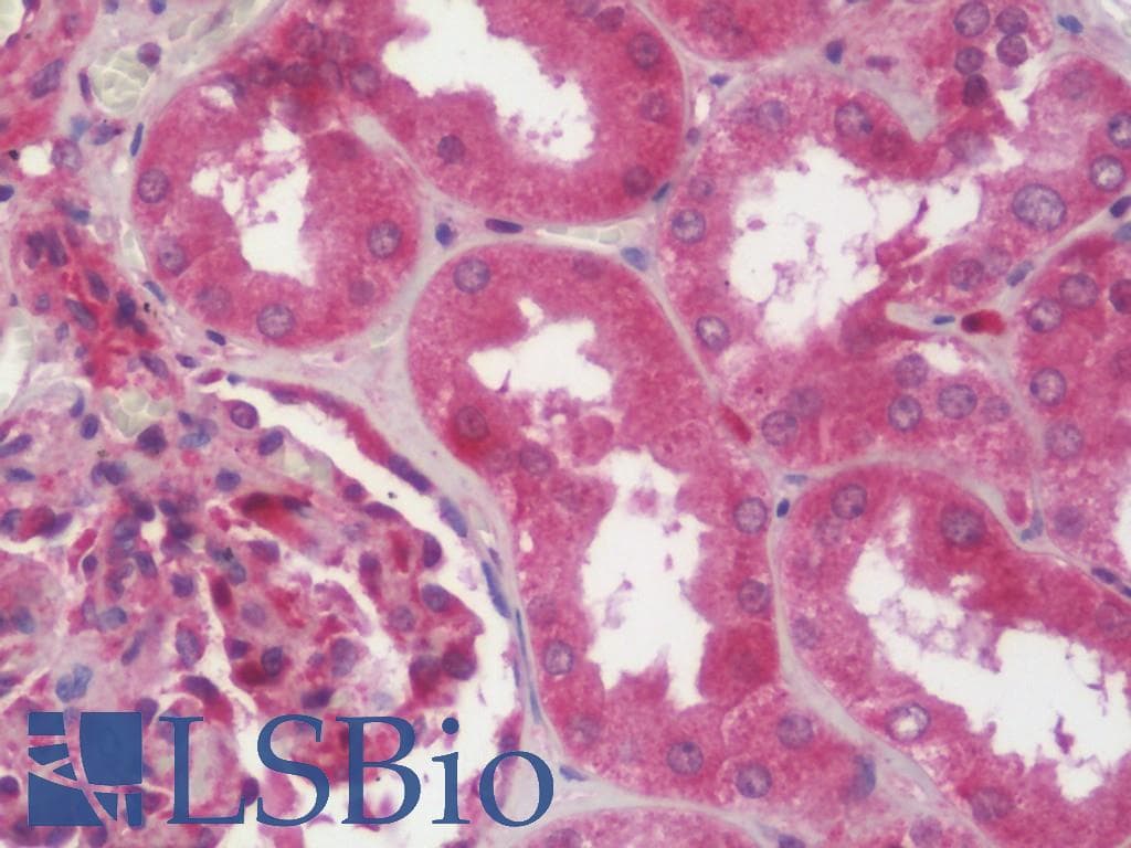 IHC-plus™ SAV1 / WW45 Antibody (aa65-92)