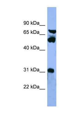 Polyclonal Rabbit anti-Human CYP8B1 Antibody (aa219-268, WB)