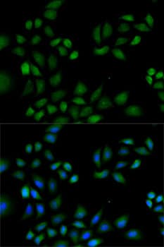 Polyclonal Rabbit anti-Human PRDX1 / Peroxiredoxin 1 Antibody (IF, WB)
