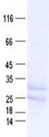 Human HOXC8 Protein (Recombinant His, N-Terminal)