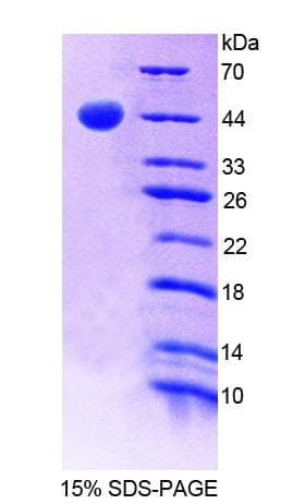 Human GHRHR Protein (Recombinant His-GST)