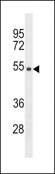 Polyclonal Rabbit anti-Human TMPPE Antibody (aa133-161, WB)