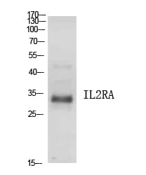 Polyclonal Rabbit anti-Human IL2RA / CD25 Antibody (WB)