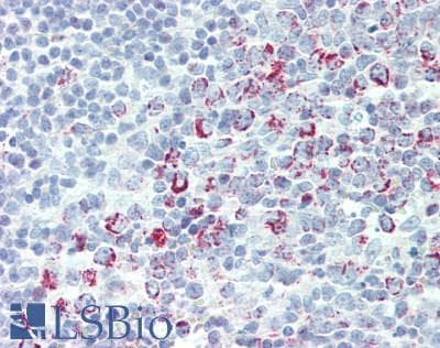 IHC-plus™ Polyclonal Rabbit anti-Human EFTU / TUFM Antibody (aa112-147, IHC, IF, WB)
