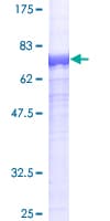 Human ECSIT Protein (Recombinant GST)