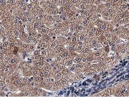 ACOT12 Antibody (clone OTI1A11)