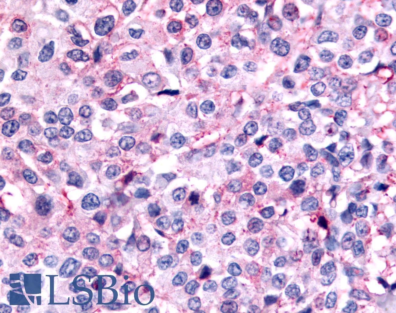 PathPlus™ Polyclonal Rabbit anti-Human PAK6 Antibody (Linker Domain, IHC)