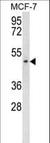 Polyclonal Rabbit anti-Human SCD5 / SCD4 Antibody (aa147-175, WB)