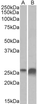 IHC-plus™ APOD / Apolipoprotein D Antibody (aa70-80)