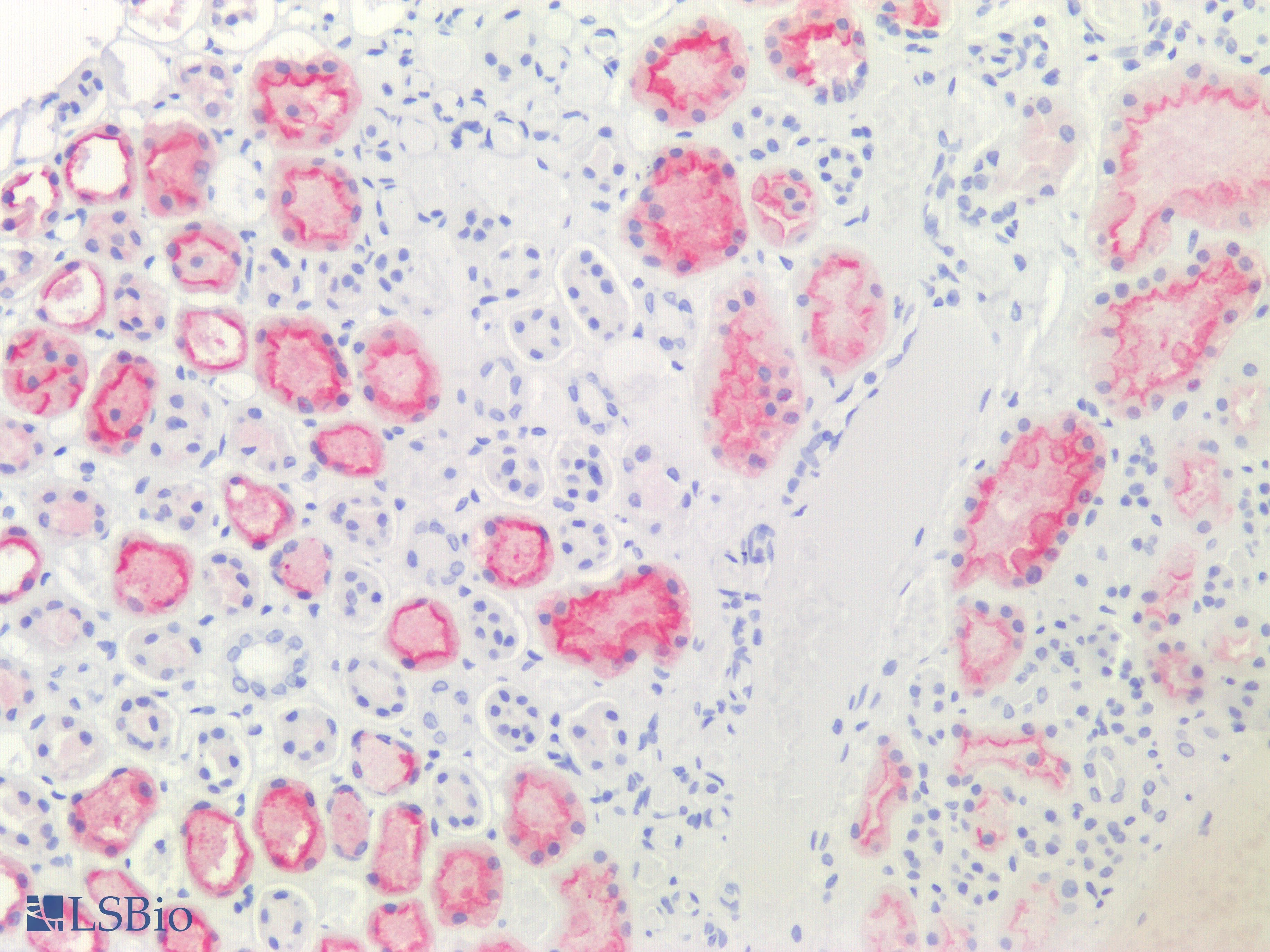 IHC-plus™ VIL1 / Villin Antibody (clone CWWB1)