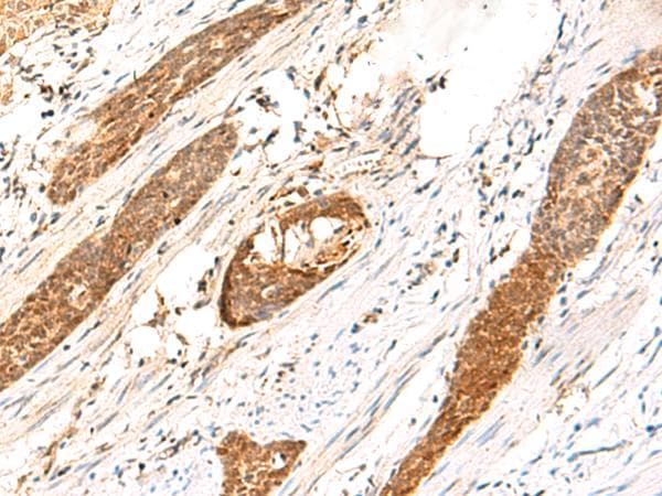 Polyclonal Rabbit anti-Human DCAF10 Antibody (IHC)