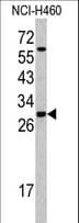 SRSF5 / SFRS5 Antibody (aa70-97)