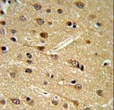 Polyclonal Rabbit anti-Human Dipeptidylpeptidase 10 / DPP10 Antibody (aa150-177, IHC, WB)