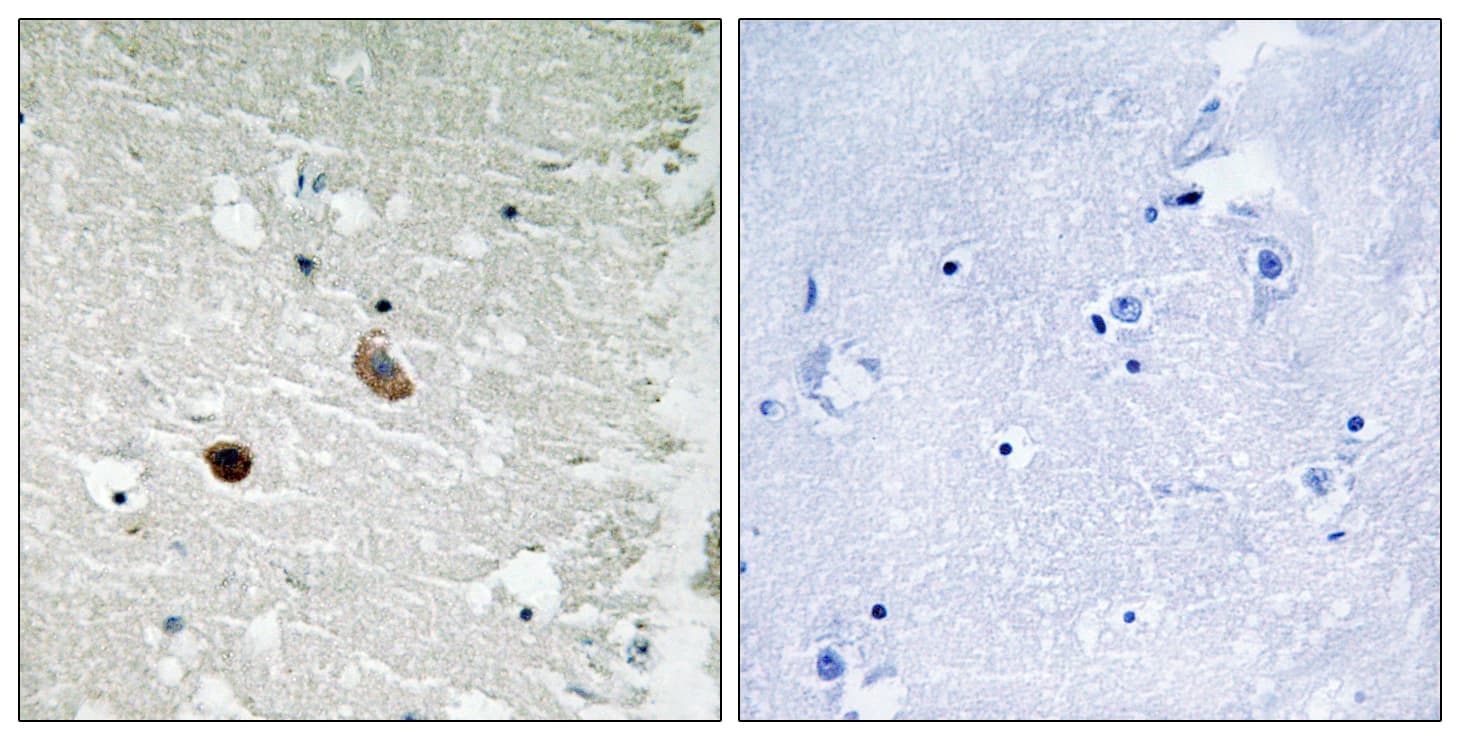 CaMKII Beta+Gamma+Delta Antibody (Internal)