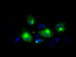 LIPG / Endothelial Lipase Antibody (clone OTI7D1)