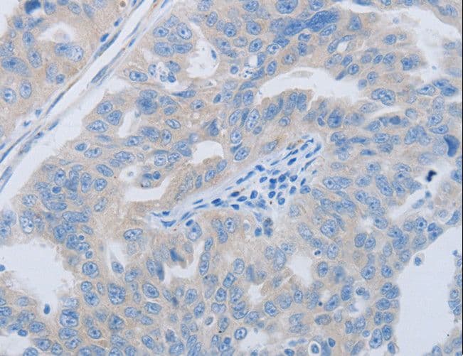 PAWR / PAR4 Antibody
