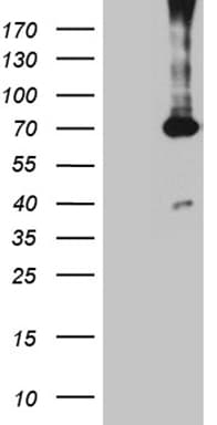 Monoclonal Mouse anti-Human PGM2L1 Antibody (clone OTI5F5, IHC, WB)