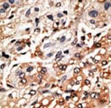 BMF Antibody (aa115-150)